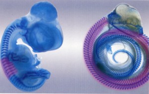 The vertebrae in which hoxc-6 is active (marked purple) in both a chick embryo and garter snake embryo.