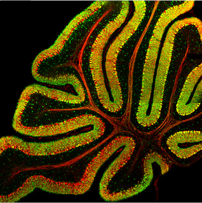 jean-marc-fritschy-beautiful-mind jean-marc-fritschy-beautiful-mind