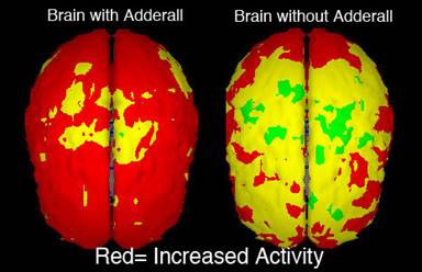 Adderall Brain